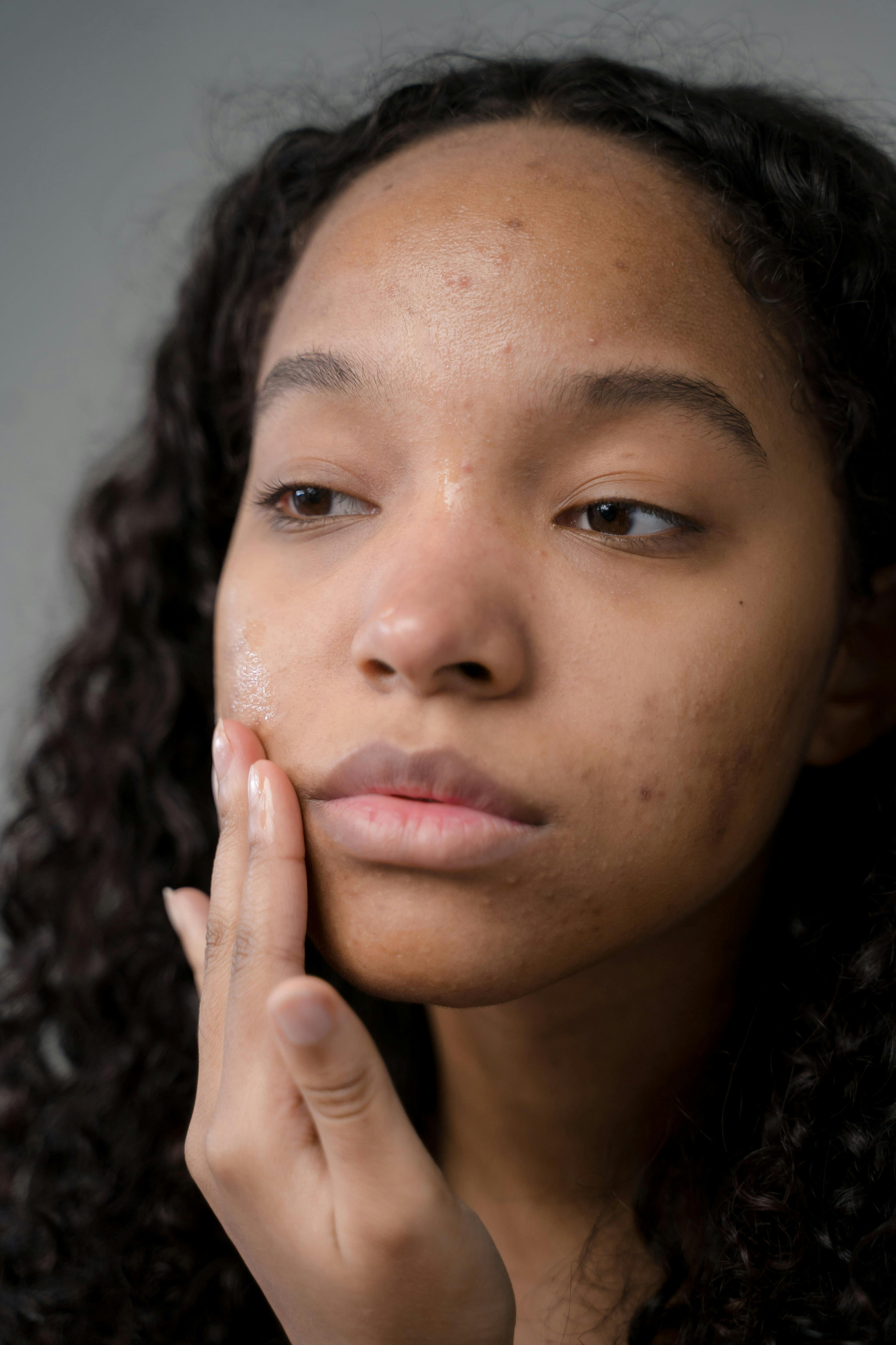 Skin concern photo
